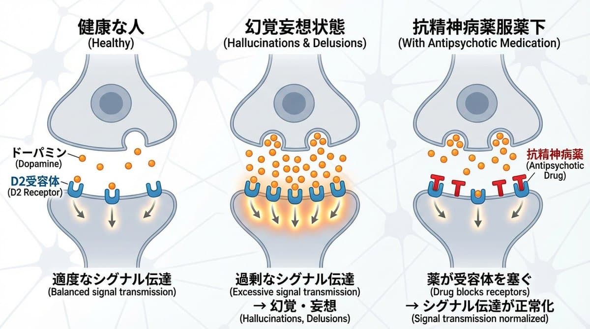 Dopamine and schizophrenia synapse diagram — example 1